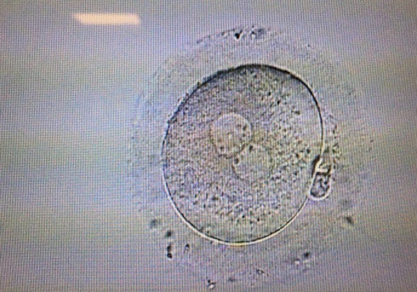 鲜胚可以培养成囊胚吗